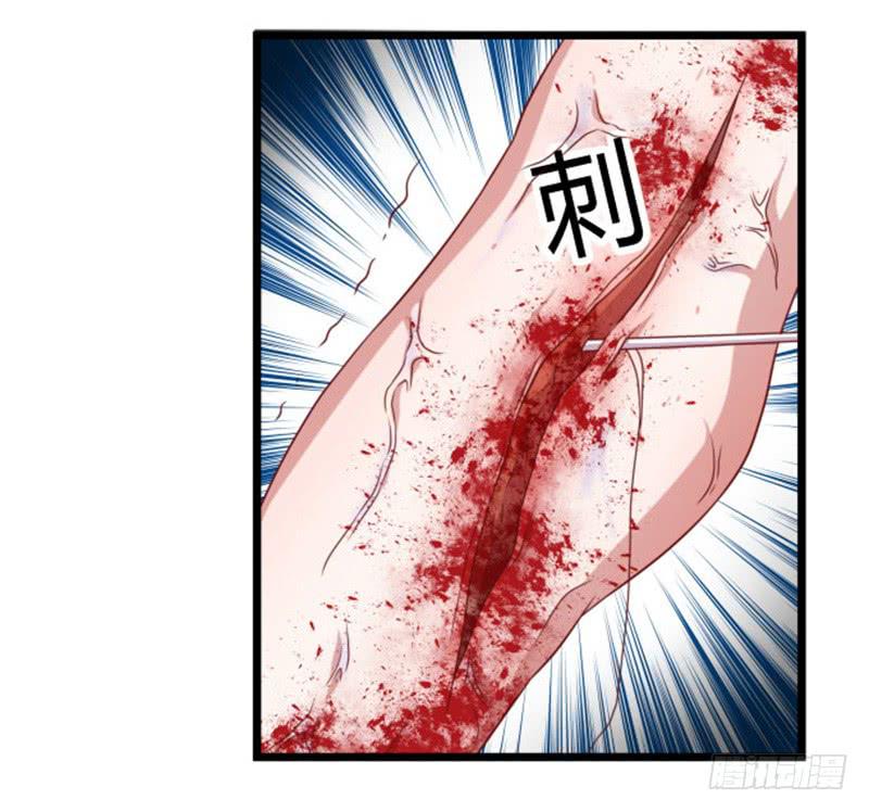 受伤的护院-第12话