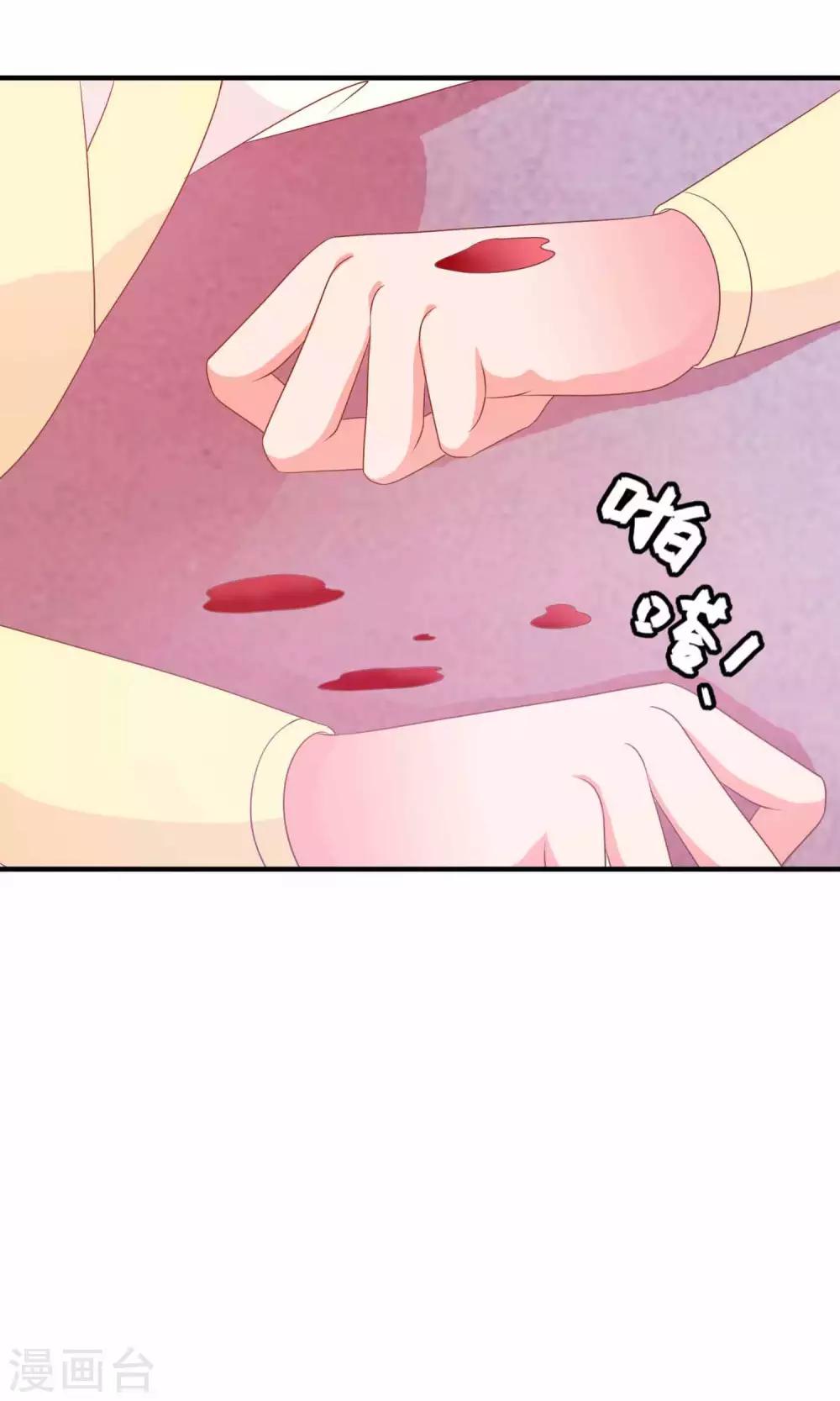 第29话 毁容才能逃过一劫-第30话