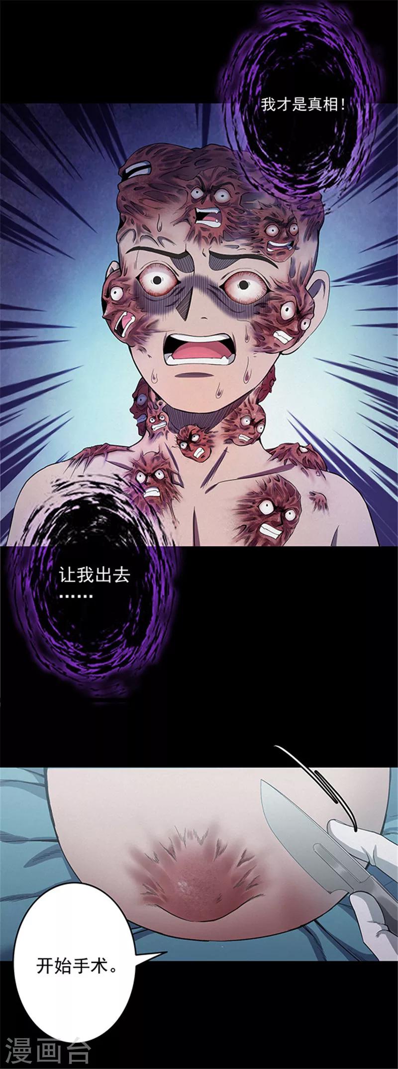 第141话 人面瘤-第144话