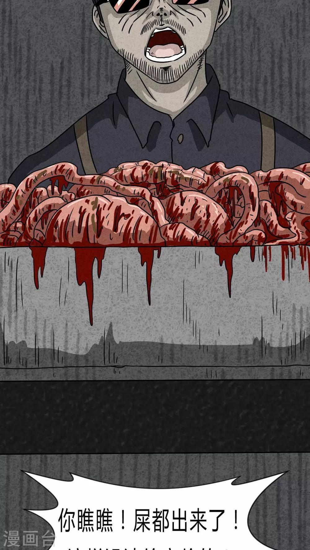 第20话 内脏大盗（上）-第20话