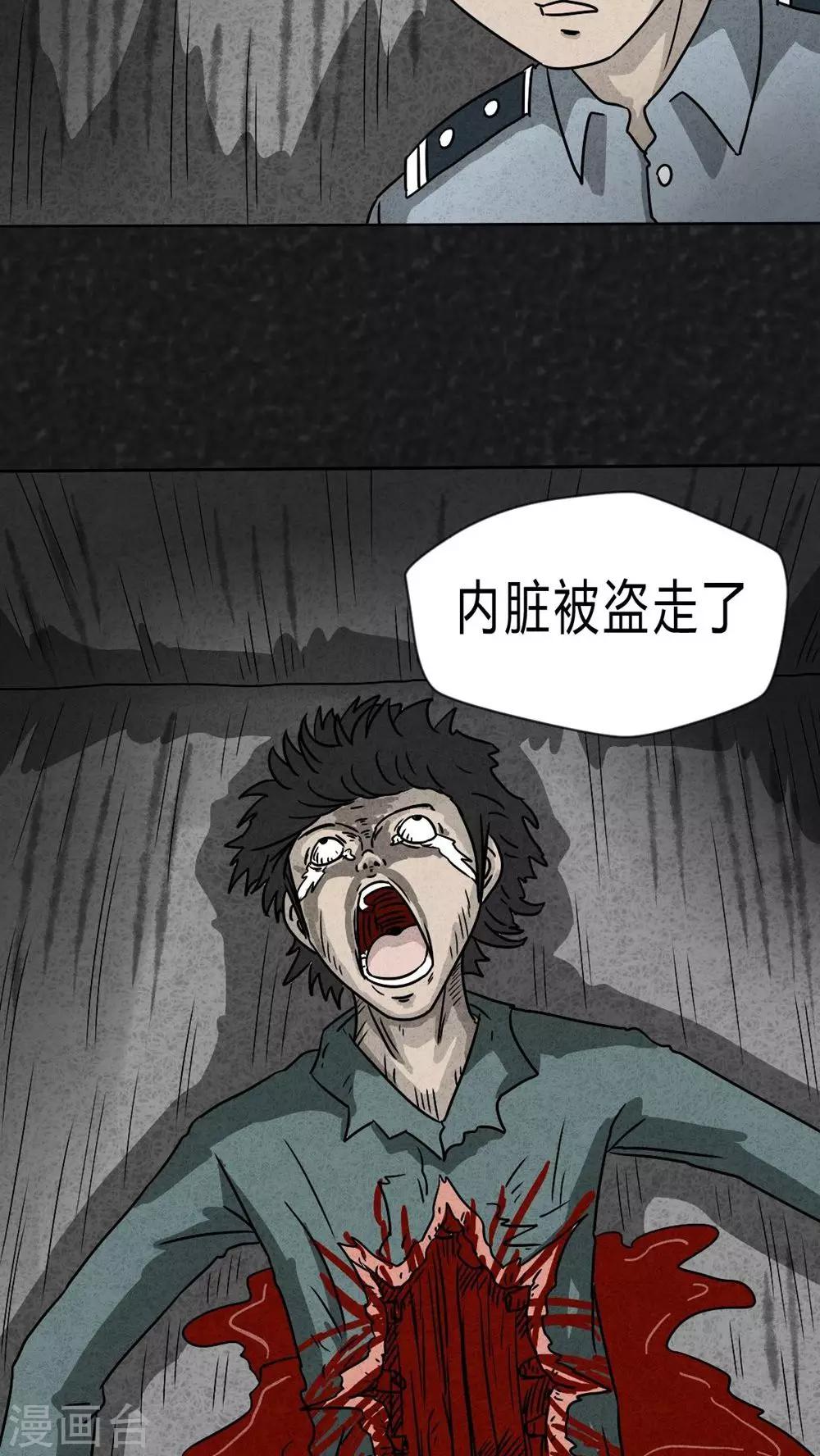 第20话 内脏大盗（上）-第20话