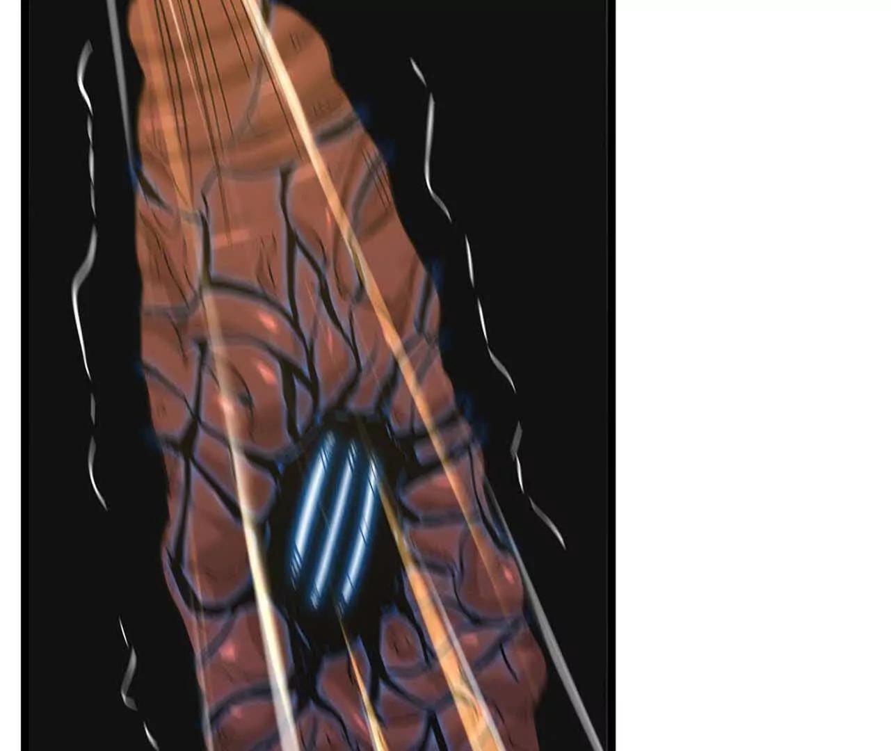 43 彻底暴走(1/3)-第44话