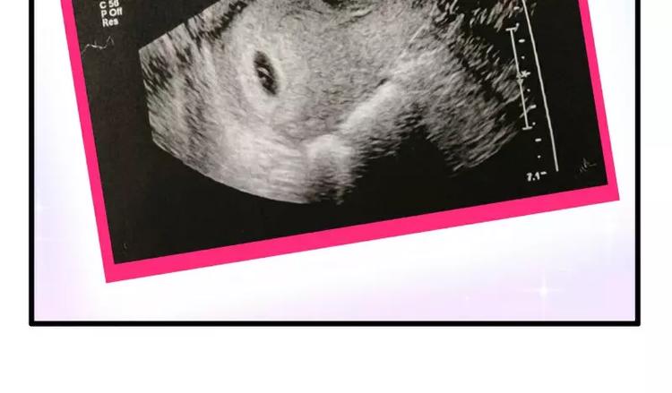 第88话 就叫他小豆子吧！(1/2)-第88话