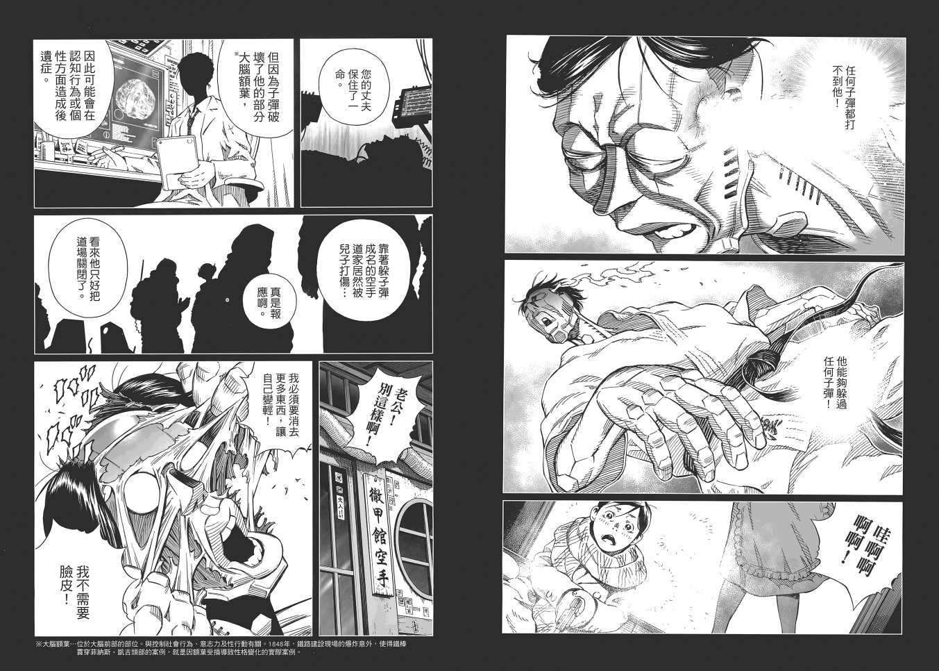 銃夢LO - 第16卷(2/2) - 5