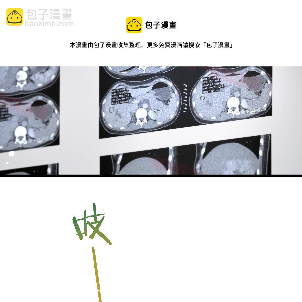 大醫凌然 - 第177話 規則，用強大碾平(1/3) - 2