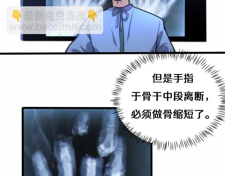 大醫凌然 - 第58話  斷指再植(2/3) - 4