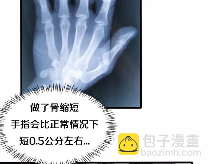 大醫凌然 - 第58話  斷指再植(2/3) - 5