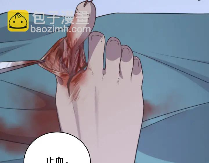 大醫凌然 - 第64話 拇指缺損再造(2/3) - 4