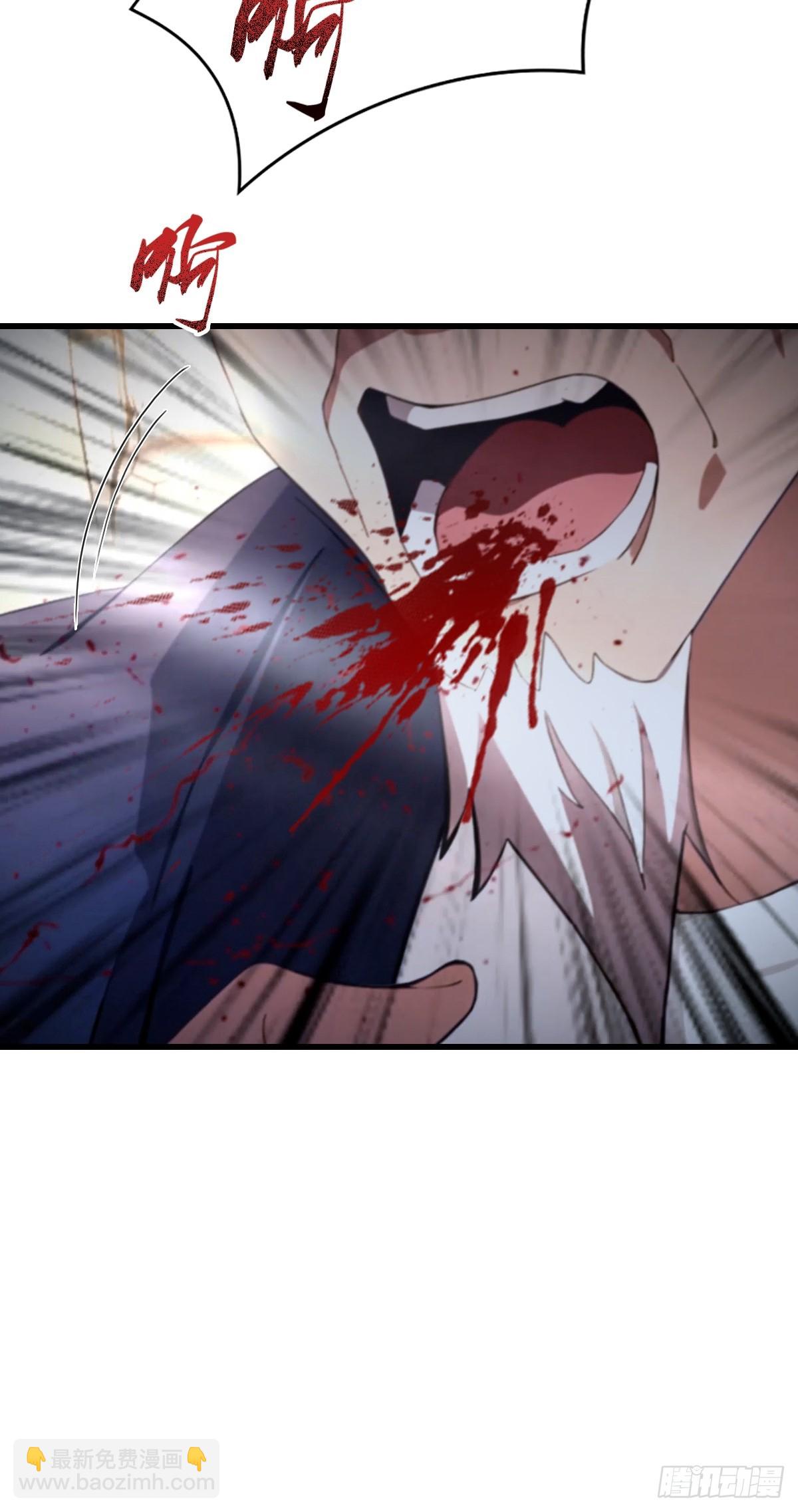 第5话 有点痛，你忍一下-第6话