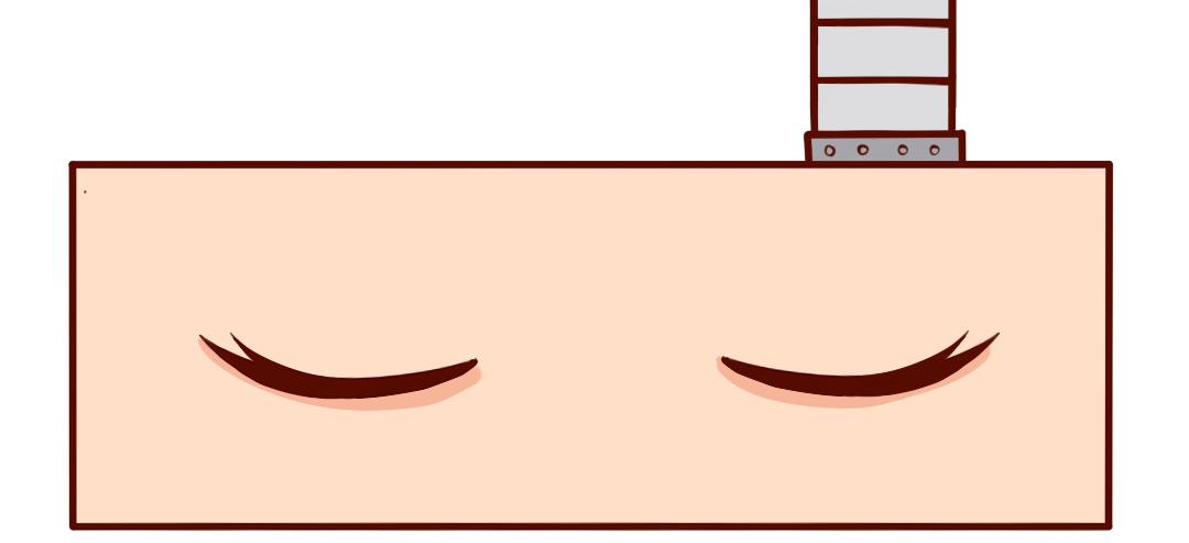 剖腹产生完孩子的6小时(1/2)-第2话