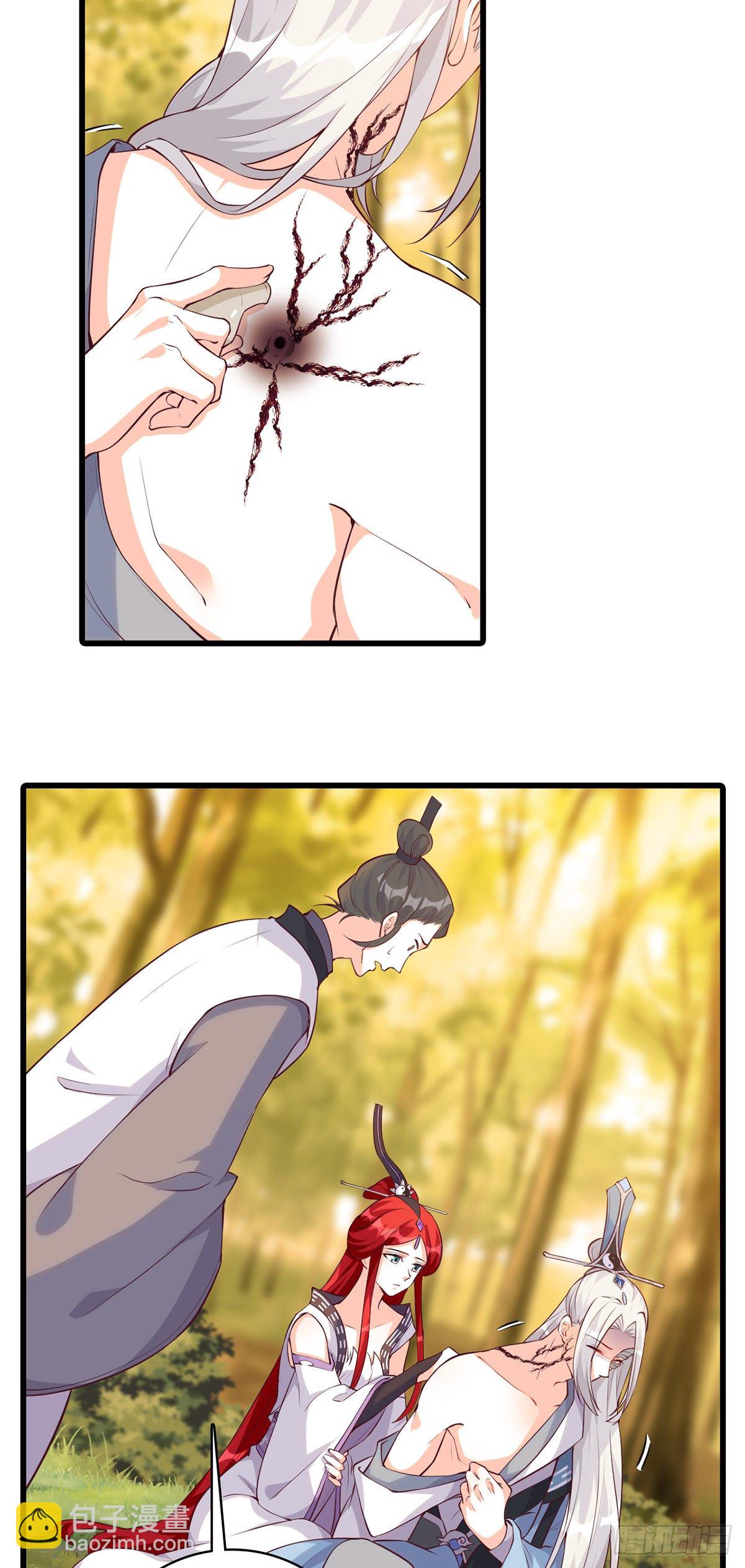 借伤撒娇？-第172话