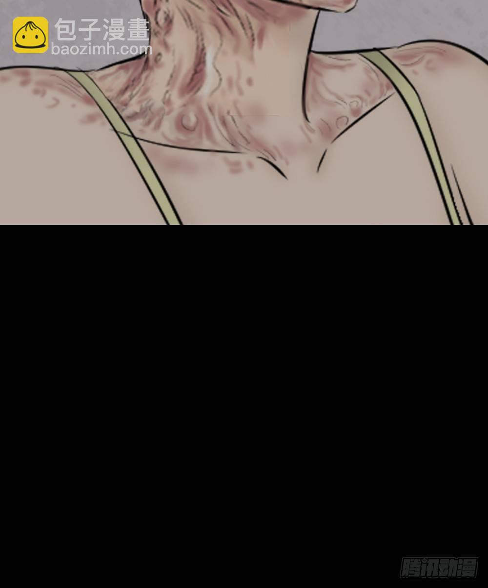 毁容相机（1）(1/2)-第2话