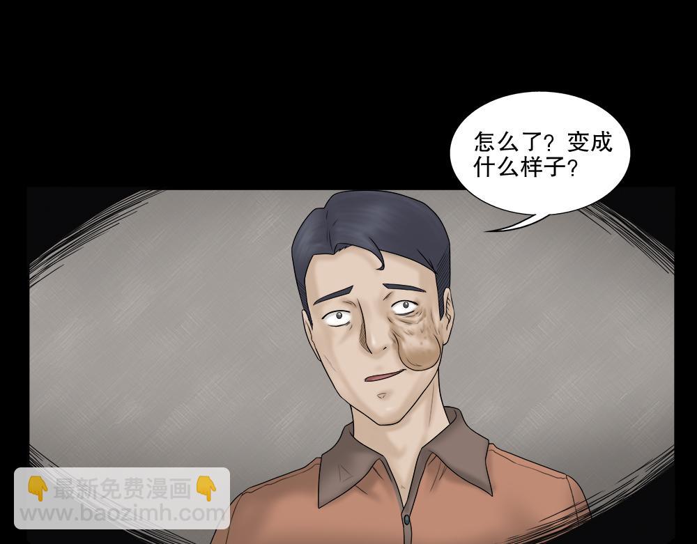 奇异的瘤(1/3)-第20话