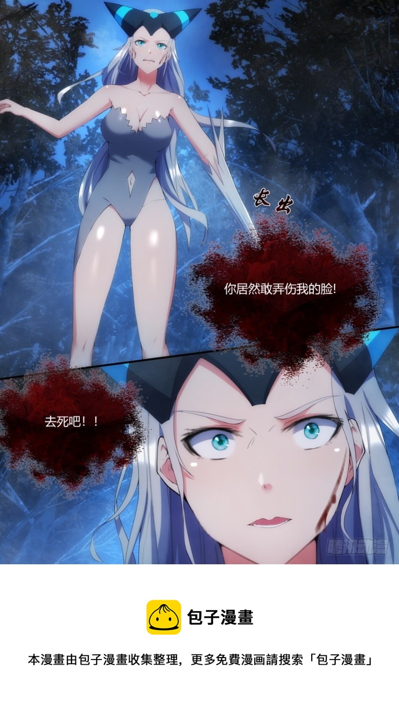 36话 竟敢弄伤我的脸-第36话