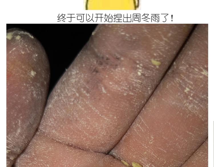 小黄鸭米糕(1/2)-第176话