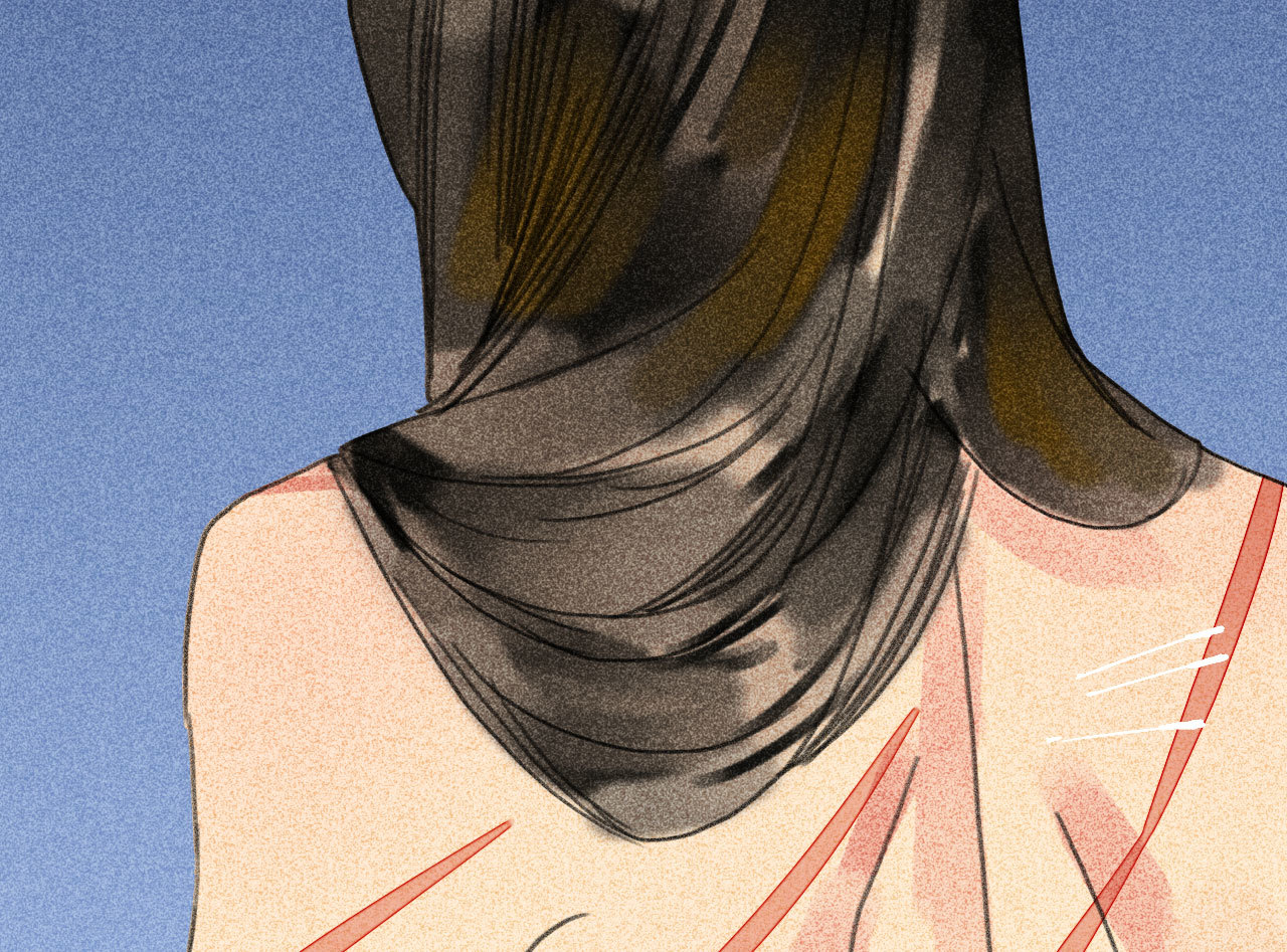 第三十二章 毒性加深(1/2)-第34话