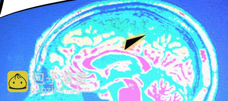 第92话 植物人(1/2)-第94话