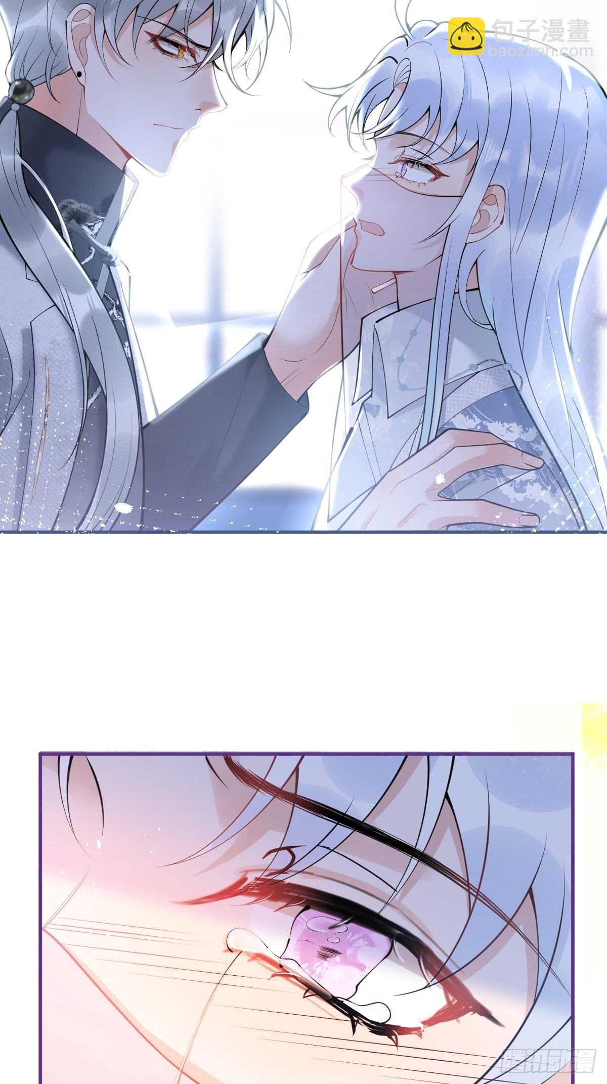 81-不许弄伤自己。(1/2)-第88话