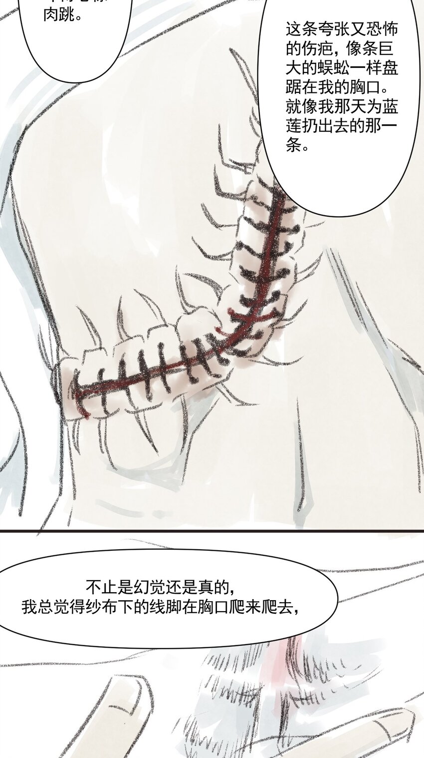 02 第二话 伤疤（中篇）(1/2)-第2话