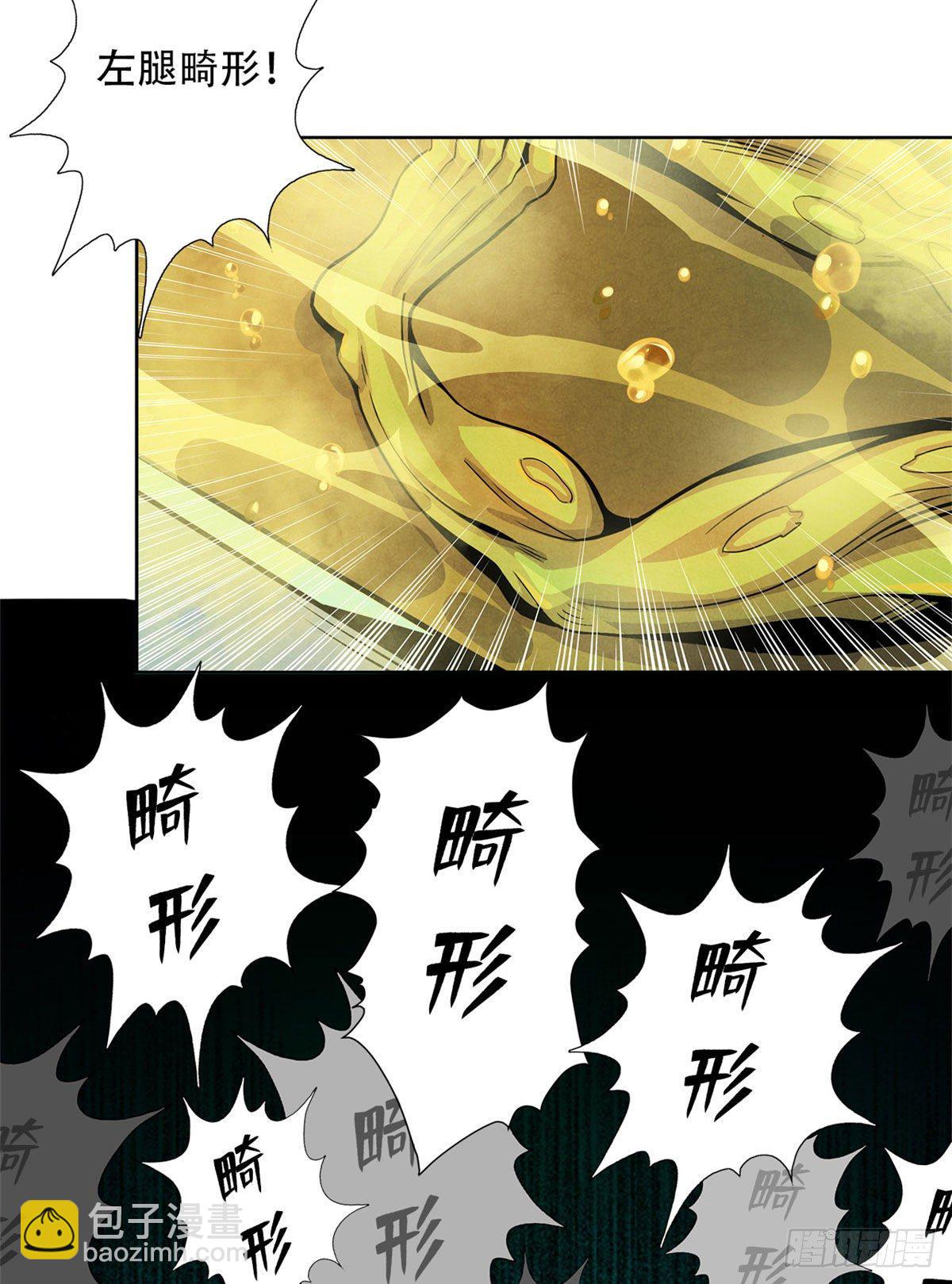 11 神秘的畸形遗体(1/2)-第12话