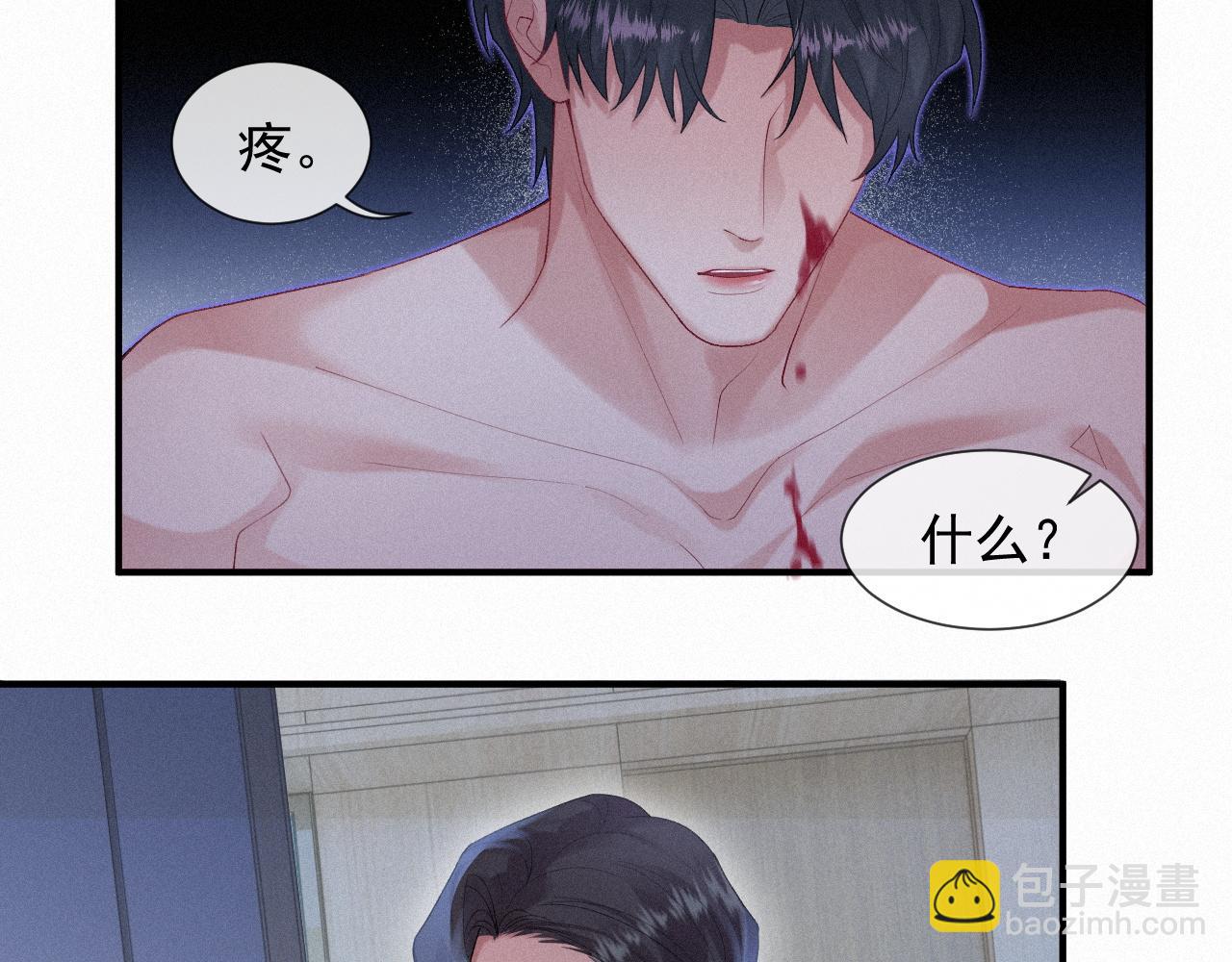第28话 我疼(1/2)-第28话