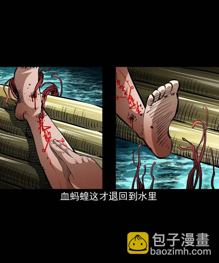 一百四十七话 吸血蚂蟥(1/2)-第148话