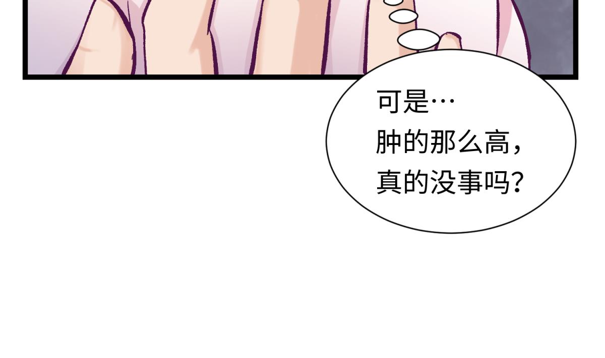 第142话 你肿了么？(1/2)-第144话