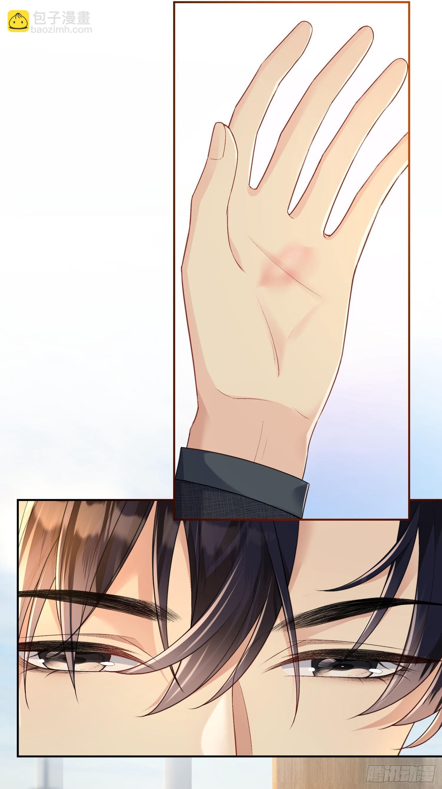 009-掌心吻(1/2)-第10话