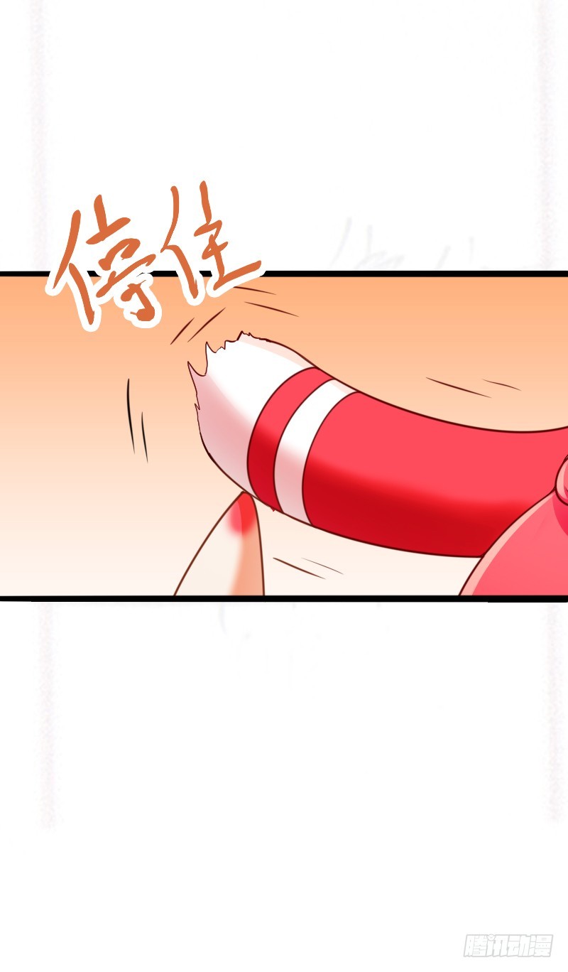 63 谜一样的受伤！-第62话