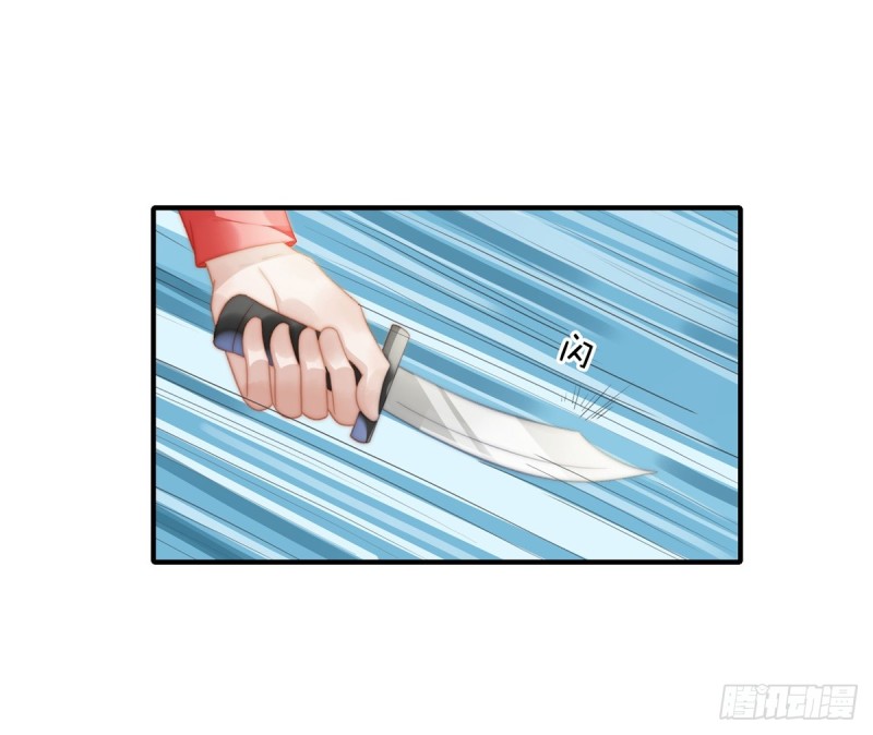 147 受伤-第102话