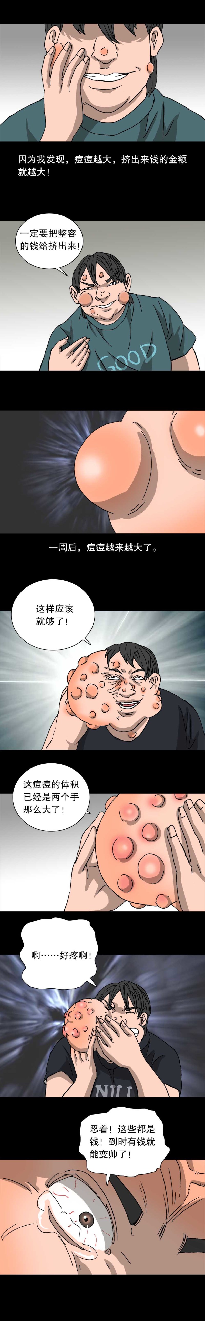 第33话 痘币男-第74话