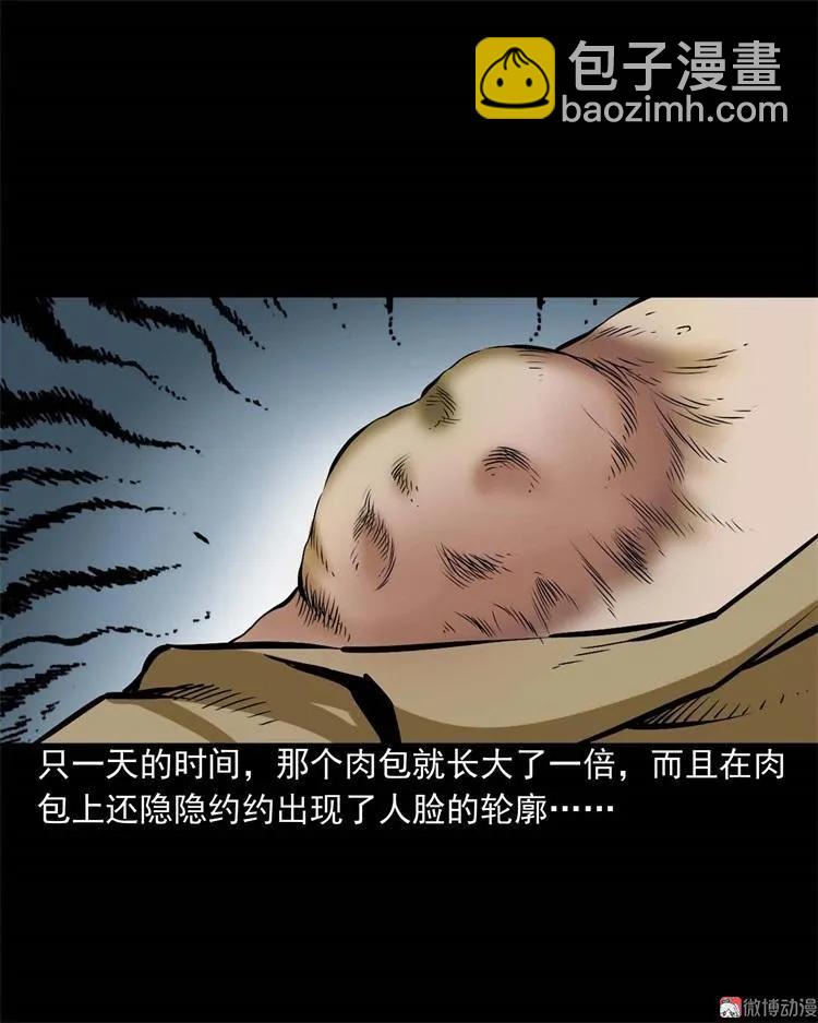 李中平的怪病(1/2)-第104话