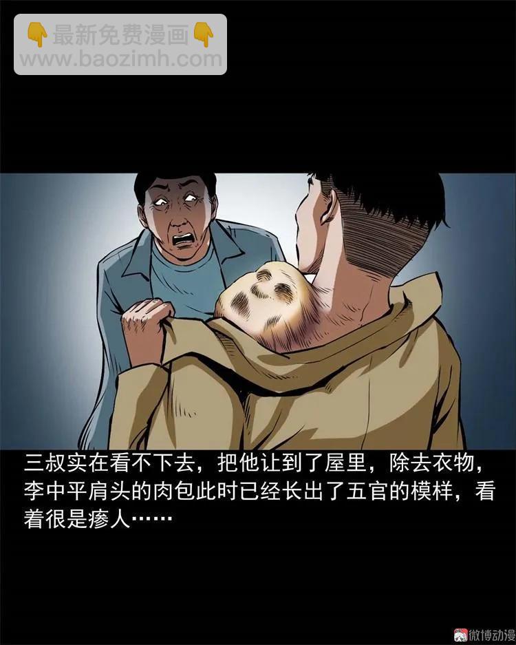 李中平的怪病(1/2)-第104话