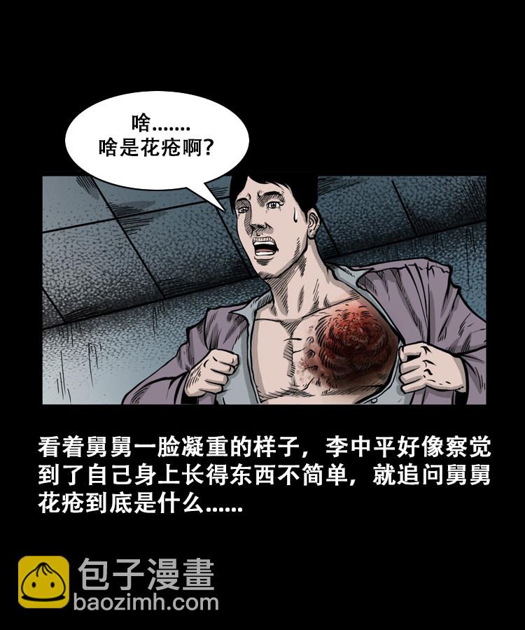 花疮咒-第20话