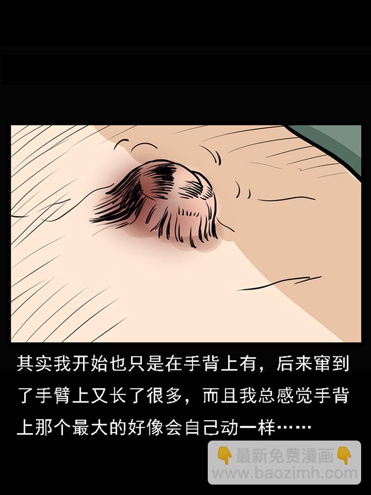 疯乞丐(1/2)-第32话