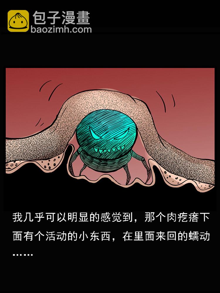 疯乞丐(1/2)-第32话