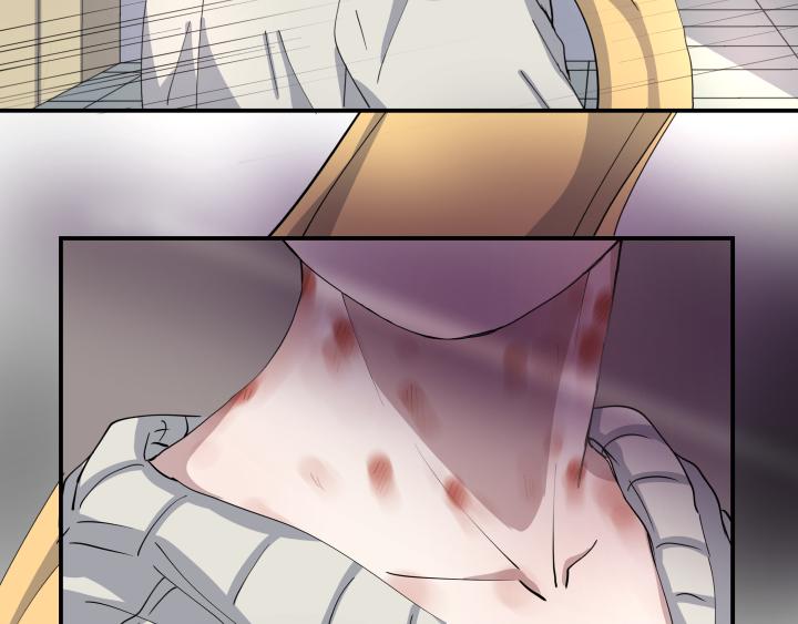 第十一话 伤痕-第12话