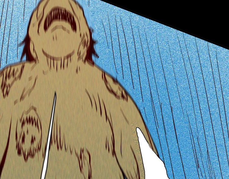 山林怪談 - 第64話 骨頭溶解症（下）(3/4) - 4