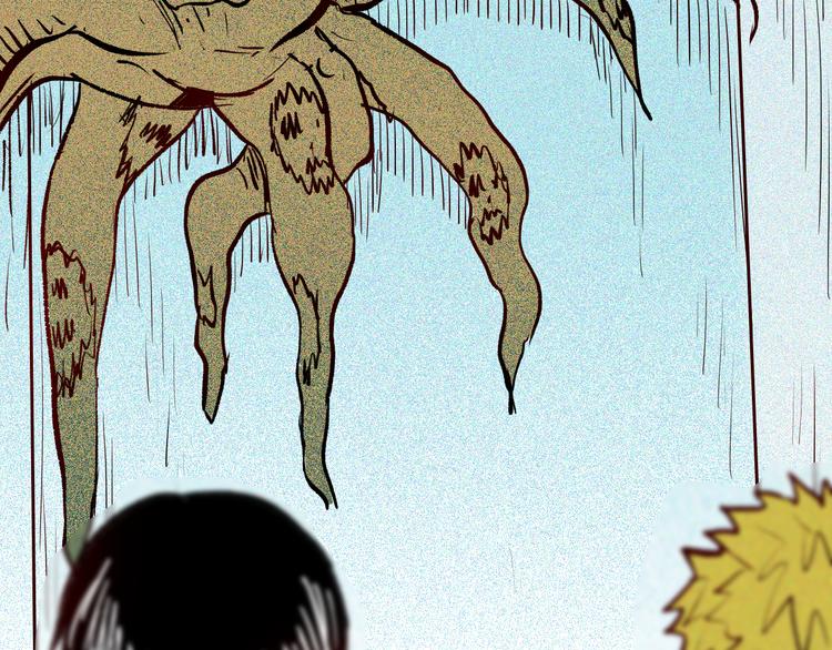 山林怪談 - 第64話 骨頭溶解症（下）(3/4) - 1