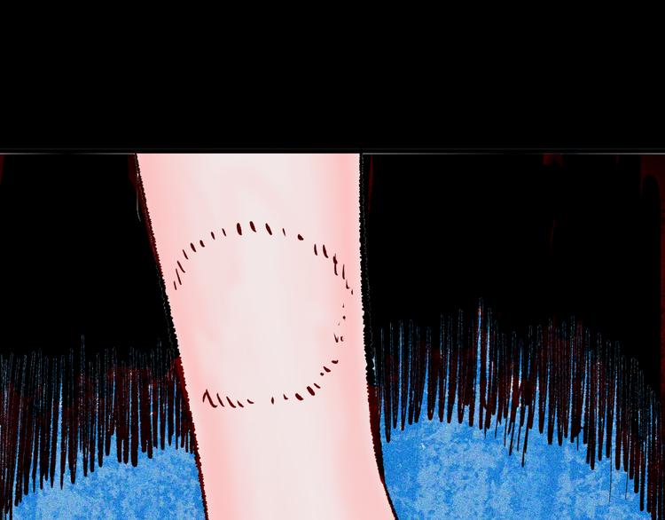 山林怪談 - 第64話 骨頭溶解症（下）(4/4) - 2