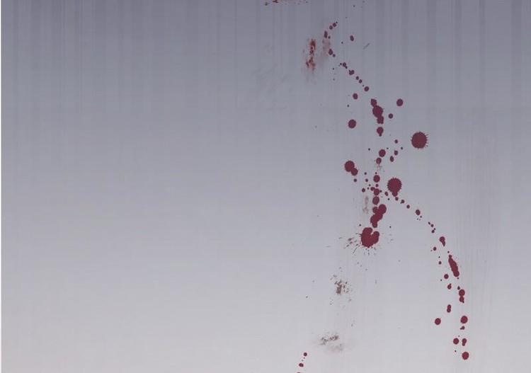 第4话这双腿留着也没用(1/2)-第4话