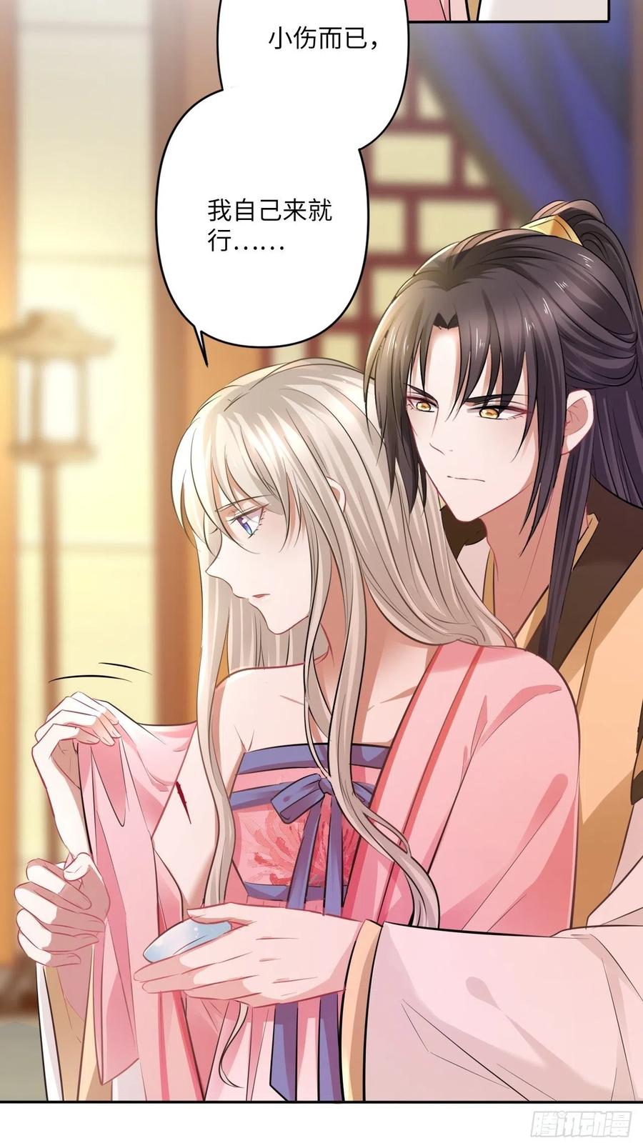 第144话：伤横累累的过去-第150话