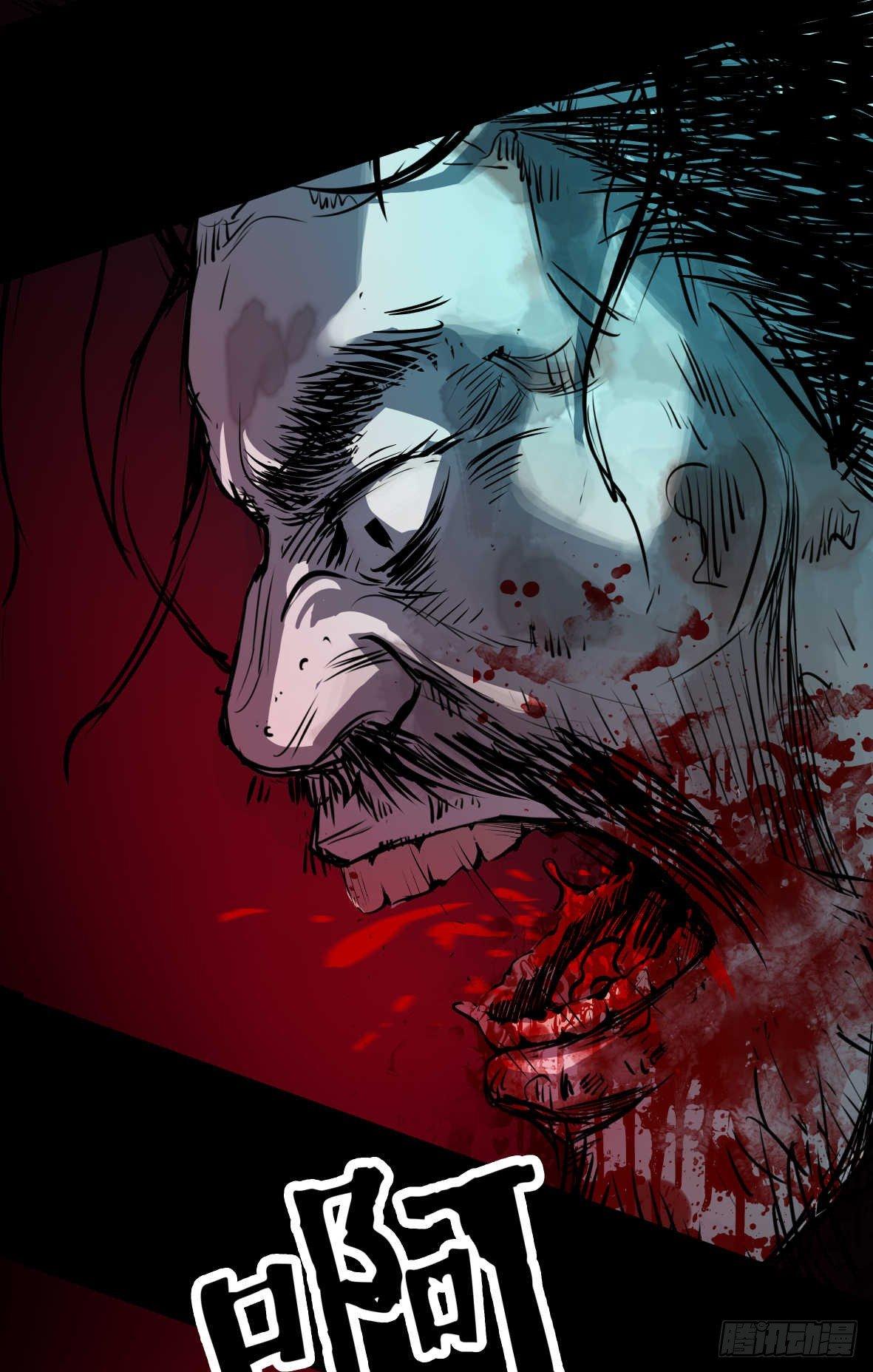 25疼！(1/2)-第26话