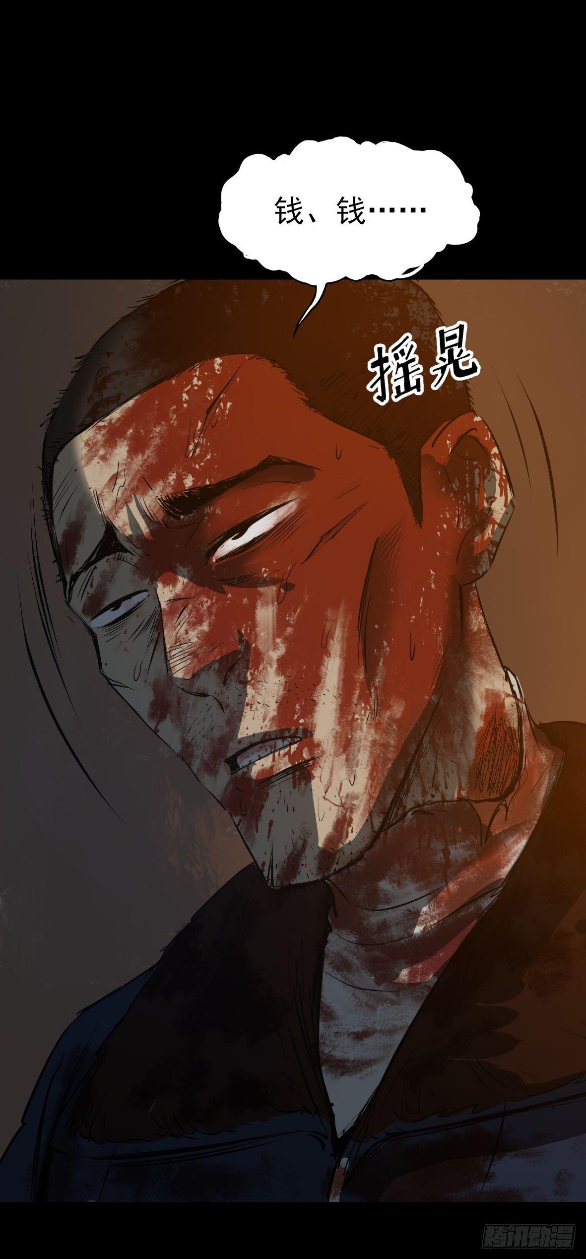 25疼！(1/2)-第26话