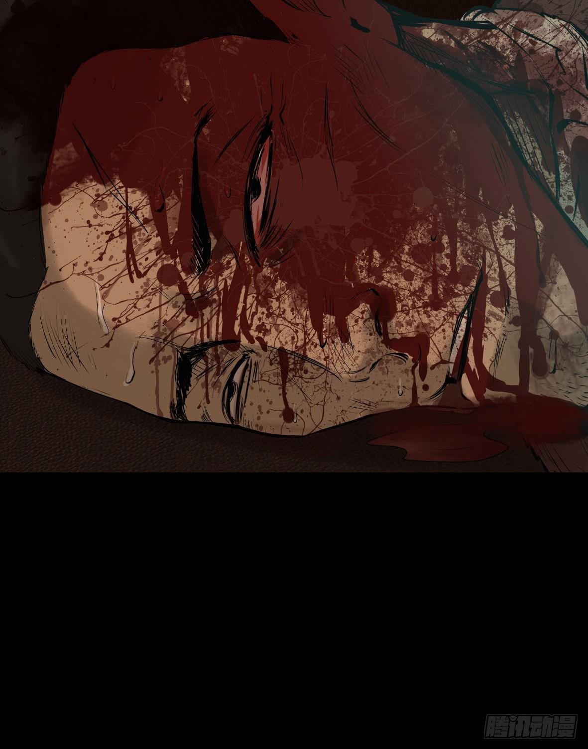 25疼！(1/2)-第26话