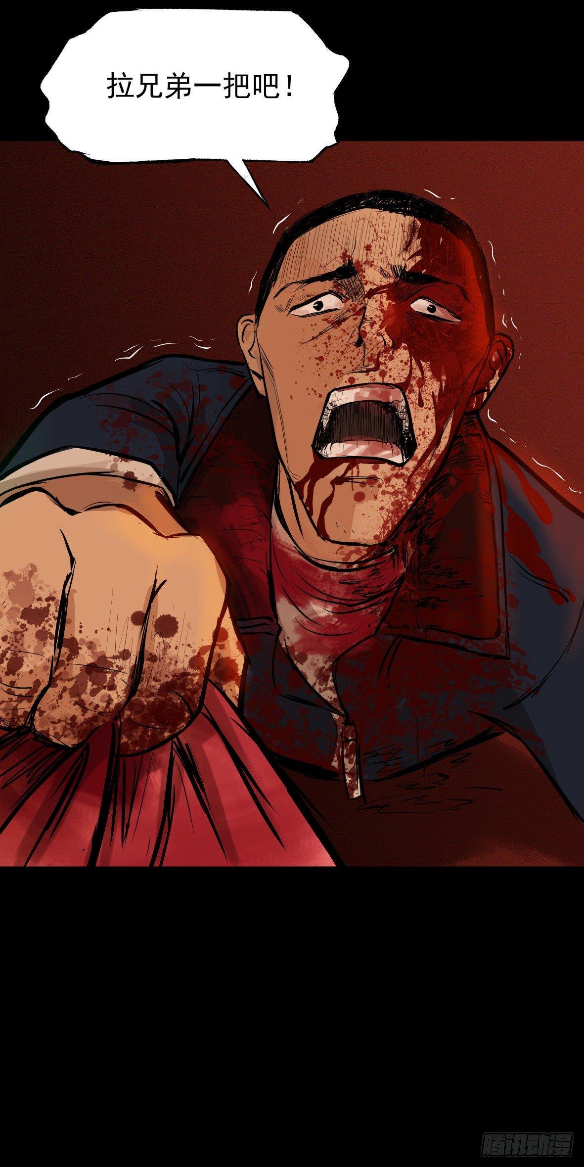 25疼！(1/2)-第26话