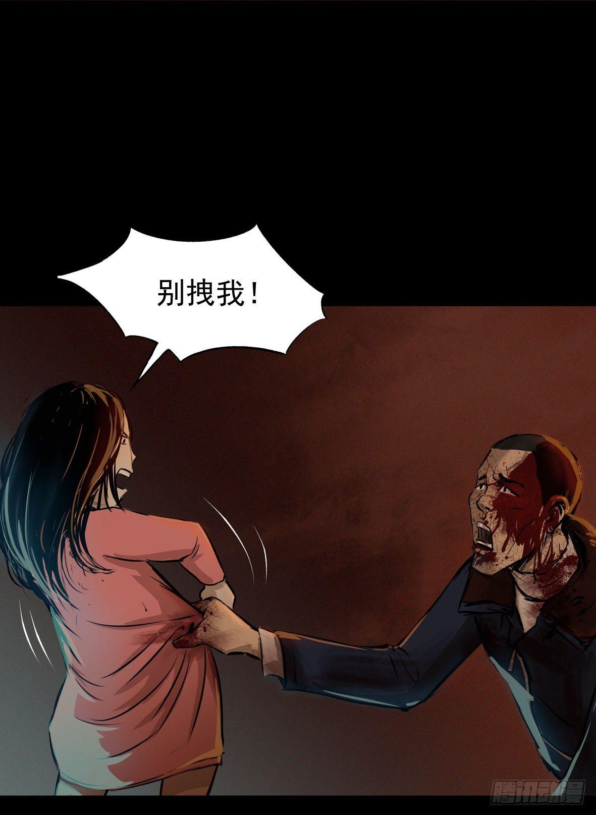 25疼！(1/2)-第26话