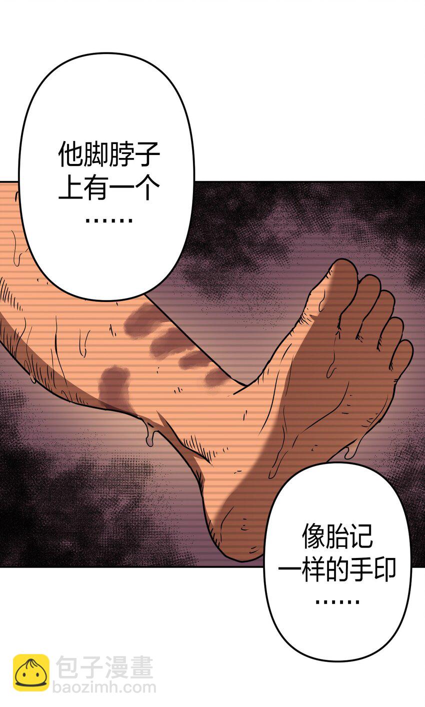 037 神秘的胎记-第38话