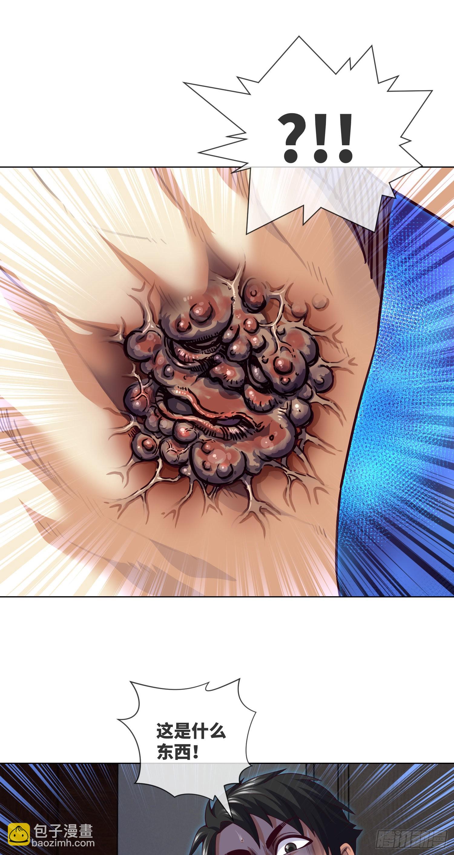 第44话 人面瘤-第46话