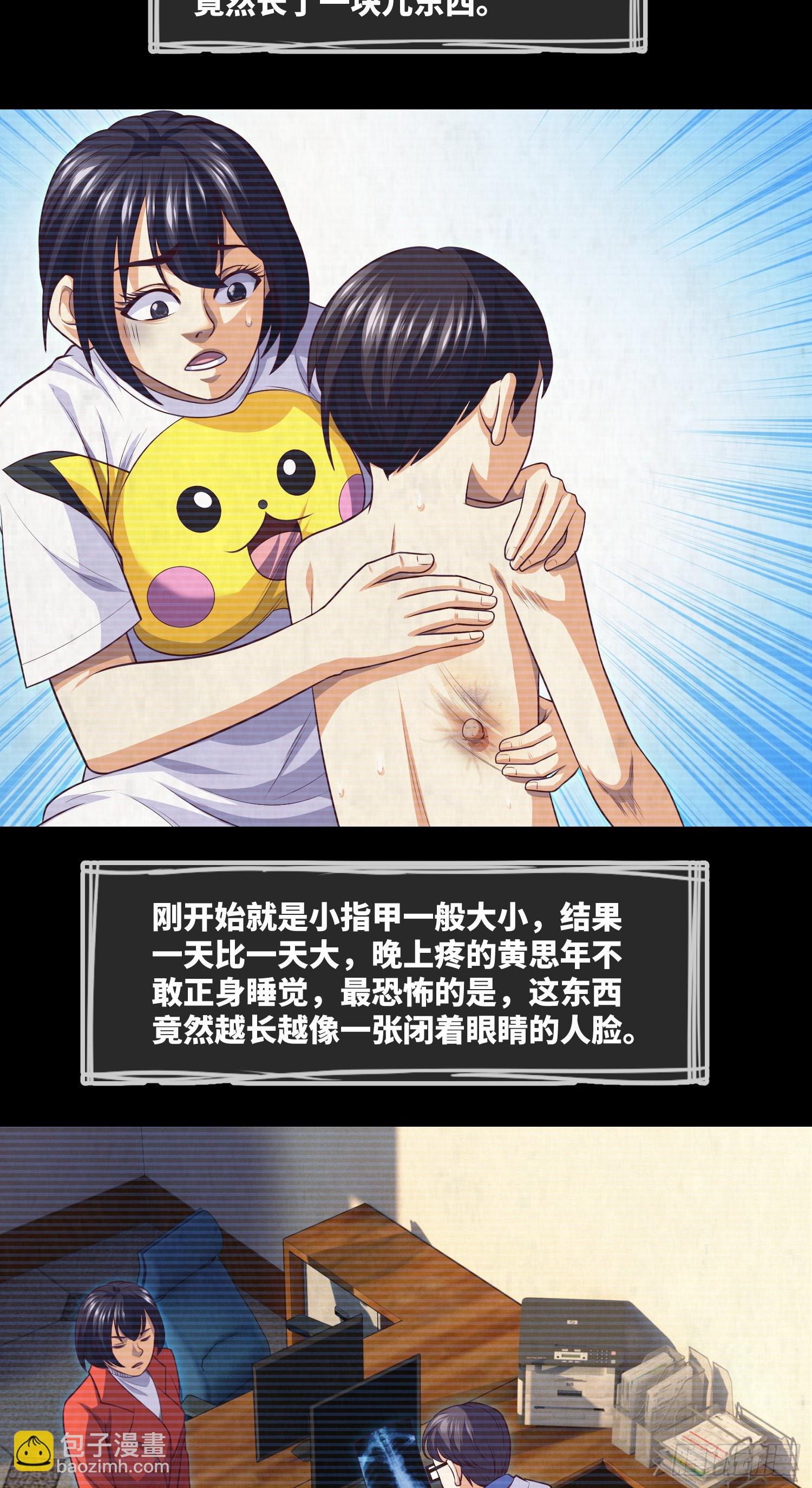 第44话 人面瘤-第46话